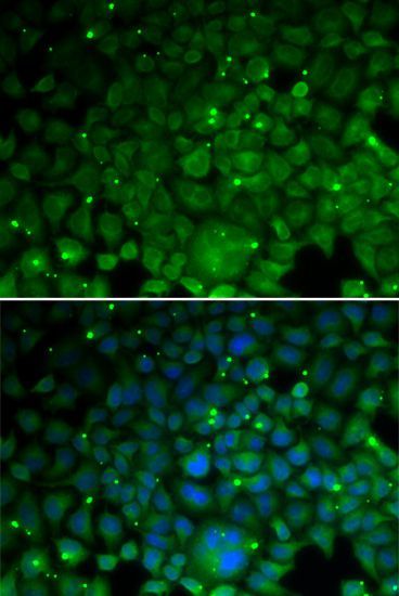 Immunofluorescence - CRYAA antibody (144-05725)