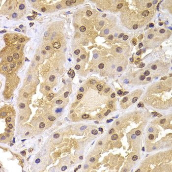 Immunohistochemistry - PHF21B antibody (144-07849)