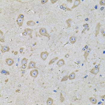 Immunohistochemistry - EIF3F Antibody (144-07023)
