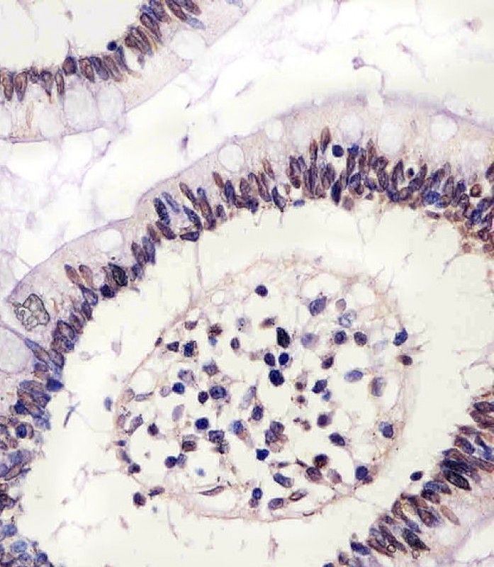 IHC-P