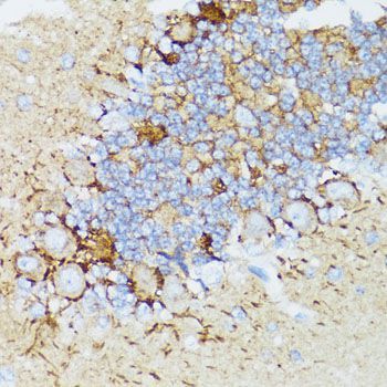 Immunohistochemistry - NEFH antibody (144-08442)