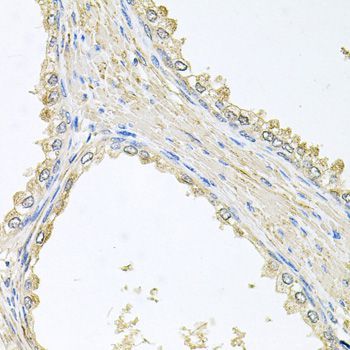Immunohistochemistry - PMM2 antibody (144-04026)