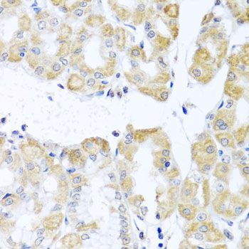Immunohistochemistry - DDX39A antibody (144-07955)