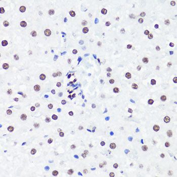 Immunohistochemistry - TriMethyl-Histone H3-K36 pAb (144-02366)