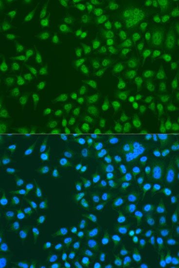 Immunofluorescence - KAT5 Polyclonal Antibody (144-01678)