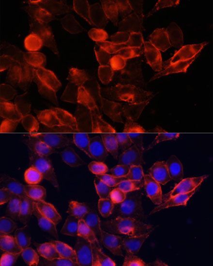 Immunohistochemistry - [KO Validated] CD44 Polyclonal Antibody (144-012410)