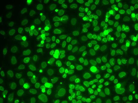 Immunohistochemistry - LMNB1 Polyclonal Antibody (144-01910)