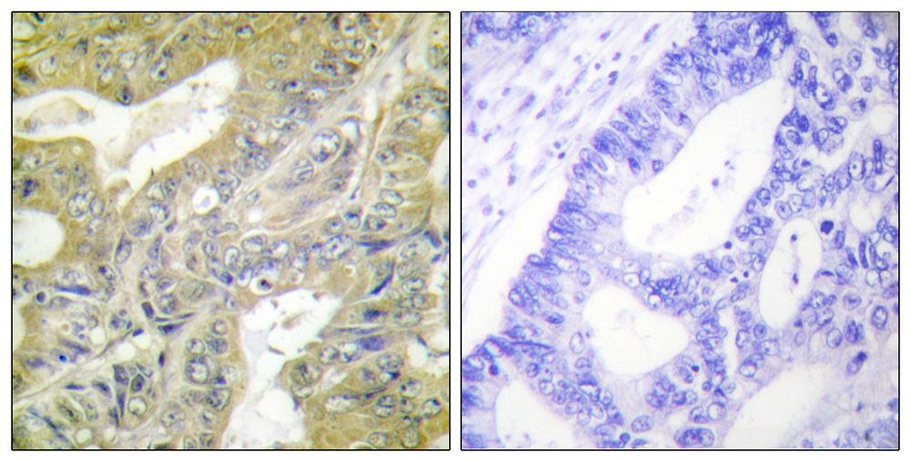 IHC