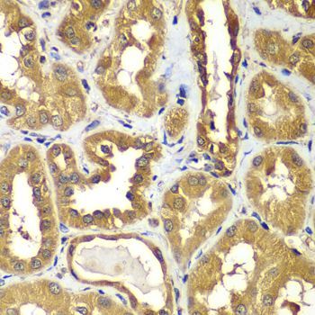 Immunohistochemistry - RAB1B antibody (144-07514)