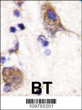 IHC-P