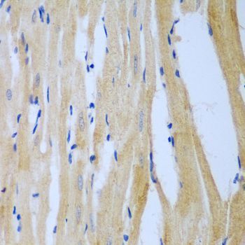 Immunohistochemistry - MGAT3 antibody (144-08134)