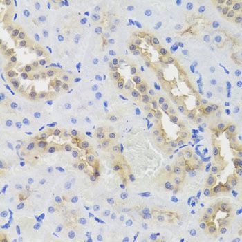 Immunohistochemistry - DISC1 Polyclonal Antibody (144-02898)