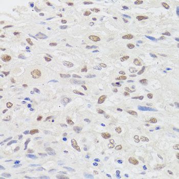 Immunohistochemistry - HMGN1 Polyclonal Antibody (144-06155)