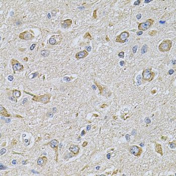 Immunohistochemistry - FASTKD1 Polyclonal Antibody (144-07384)