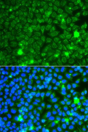 Immunofluorescence - GBA3 antibody (144-07827)