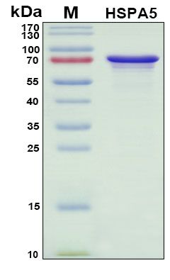 SDS-PAGE