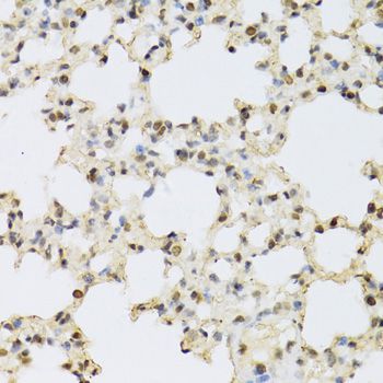 Immunohistochemistry - MAPK3 Polyclonal Antibody (144-00228)