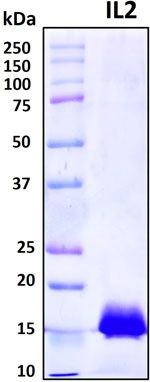 SDS-PAGE