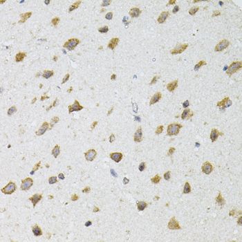 Immunohistochemistry - [KO Validated] SIRT3 Polyclonal Antibody (144-05718)
