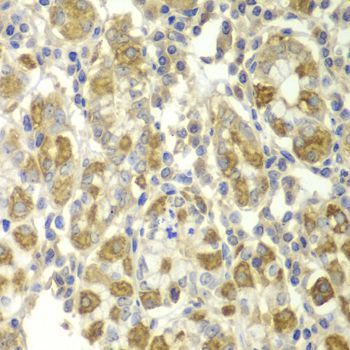 Immunohistochemistry - TNF-? Polyclonal Antibody (144-011534)
