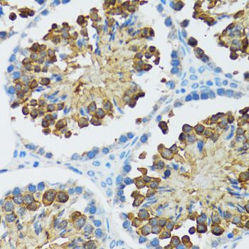 Immunohistochemistry - Caspase3 Polyclonal Antibody (144-60067)