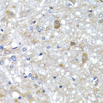 Immunohistochemistry - ETFA antibody (144-07670)