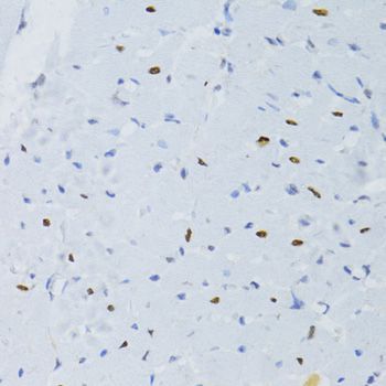 Immunohistochemistry - SNRNP70 antibody (144-06065)