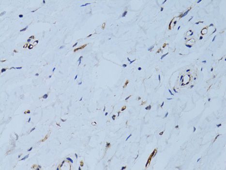 Immunohistochemistry - SELE Antibody (144-02191)