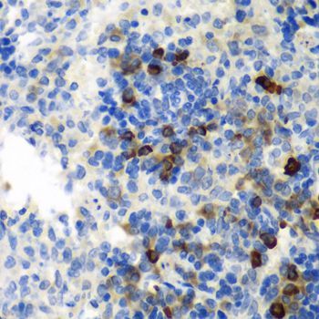 Immunohistochemistry - AIMP1 antibody (144-05301)