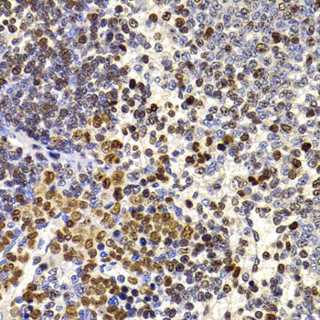 Immunohistochemistry - HIRIP3 antibody (144-07014)