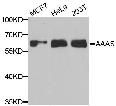Western blot - AAAS antibody (144-06427)