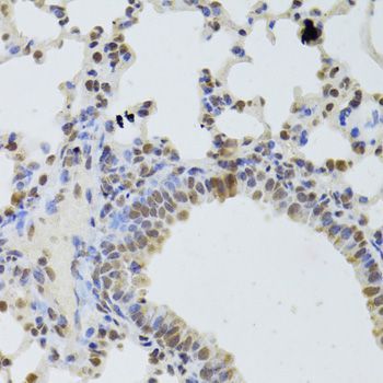 Immunohistochemistry - DDX1 Polyclonal Antibody (144-06575)