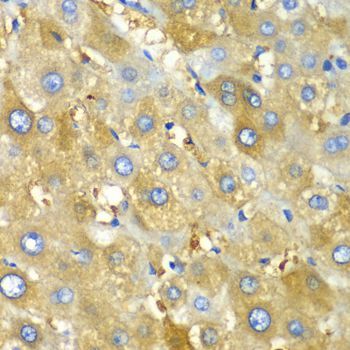 Immunohistochemistry - CHIA Polyclonal Antibody (144-61364)