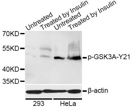 Western blot - Phospho-GSK3A-S21 pAb (144-50582)