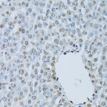 Immunohistochemistry - HNF4A Antibody (144-02085)