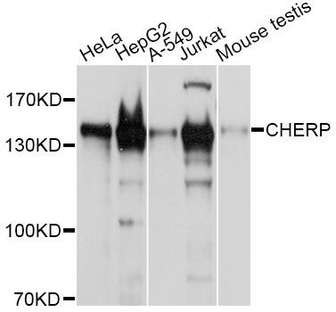 Western blot - CHERP antibody (144-09702)