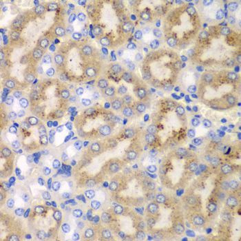 Immunohistochemistry - AIMP1 antibody (144-05301)