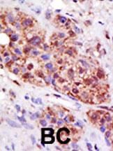 IHC-P