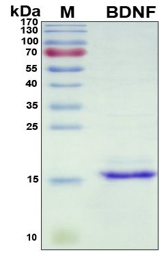 SDS-PAGE