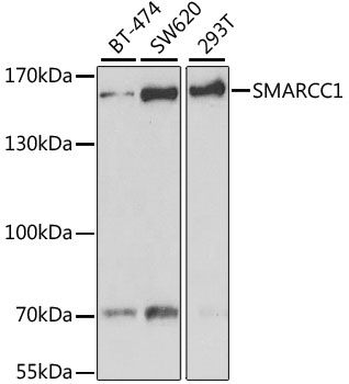 Western blot - [KO Validated] SMARCC1 Polyclonal Antibody (144-06128)