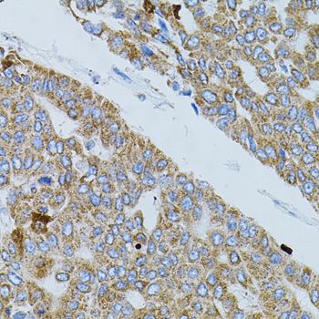 Immunohistochemistry - [KO Validated] GNA13 Polyclonal Antibody (144-05746)