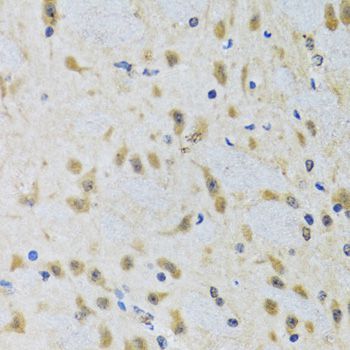 Immunohistochemistry - ATG7 Polyclonal Antibody (144-00691)