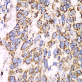 Immunohistochemistry - ATP5A1 Polyclonal Antibody (144-05884)