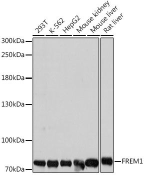 Western blot