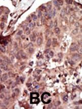 IHC-P