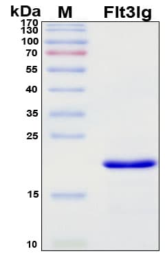 SDS-PAGE Image