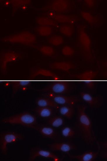 Immunofluorescence - KPNA1 antibody (144-60415)