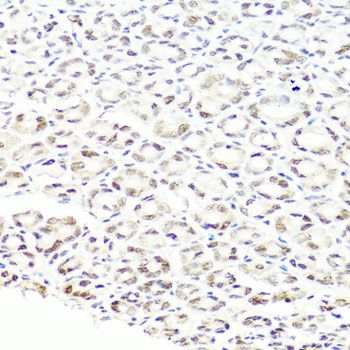 Immunohistochemistry - PRPF8 Polyclonal Antibody (144-06053)