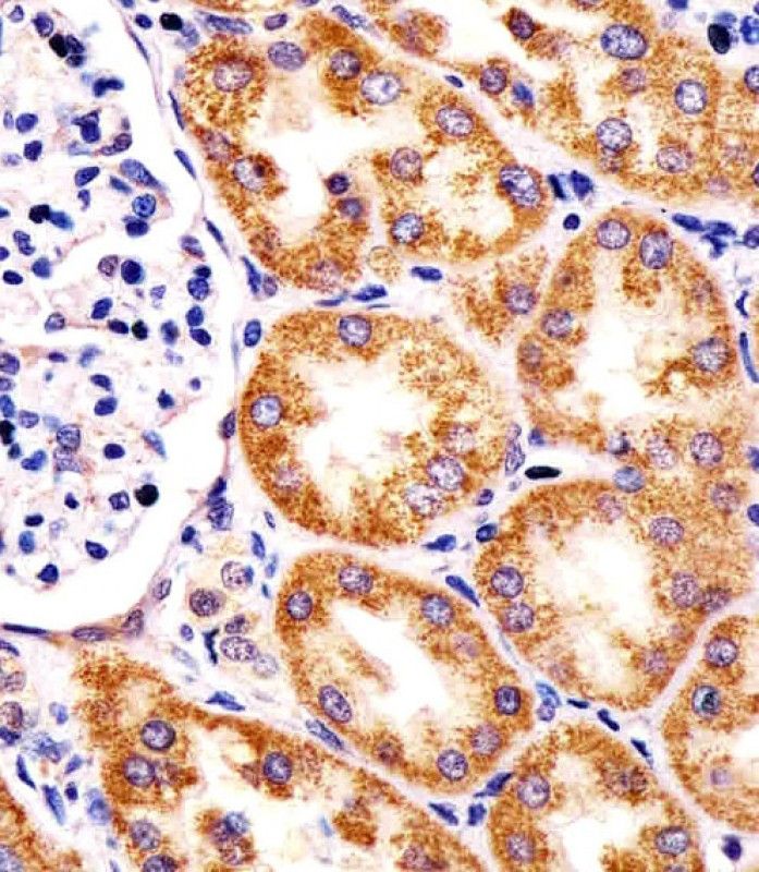 IHC-P