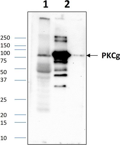 Western blot